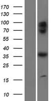 C17orf59 Protein (Over-Expression Lysate Myc-DDK (Flag))