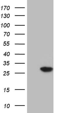 NUDT4 Antibody (clone OTI1C2)