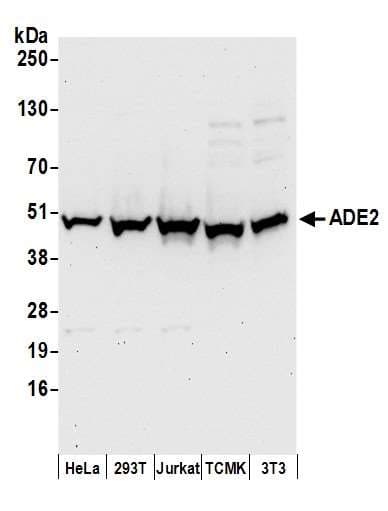 PAICS / ADE2 Antibody (aa300-350)