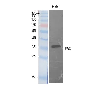 CD95 / FAS Antibody