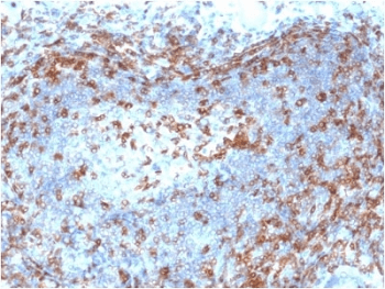 Monoclonal Mouse anti-Human ZAP70 Antibody (clone ZAP70/2046, IHC)