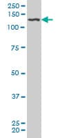 PDGFRB / PDGFR Beta Antibody (clone 4C12)