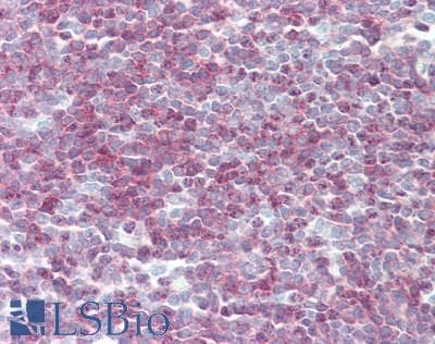IHC-plus™ CD79A / CD79 Alpha Antibody (clone ZL7-4)
