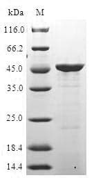 Human ITGA2 / CD49b Protein (Recombinant 6His-SUMO, N-terminus)