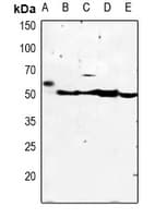 Polyclonal Rabbit anti-Human KCNJ4 / Kir2.3 Antibody (WB)