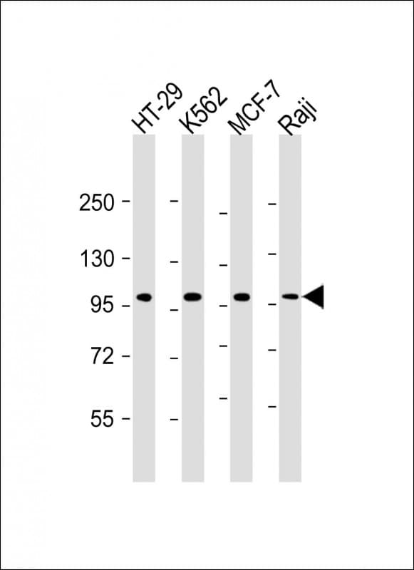 Monoclonal Mouse anti-Human TPX2 Antibody (clone 1696CT464.66.9, WB)