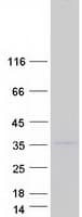 Human PLSCR5 Protein (Recombinant Myc-DDK (Flag))