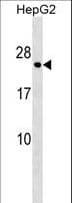 HLA-DPA1 Antibody (aa231-259)