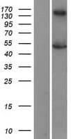 NR1H2 / LXR Beta Protein (Over-Expression Lysate Myc-DDK (Flag))