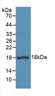 EIF4EBP1 / 4EBP1 Antibody (aa2-117, PE)