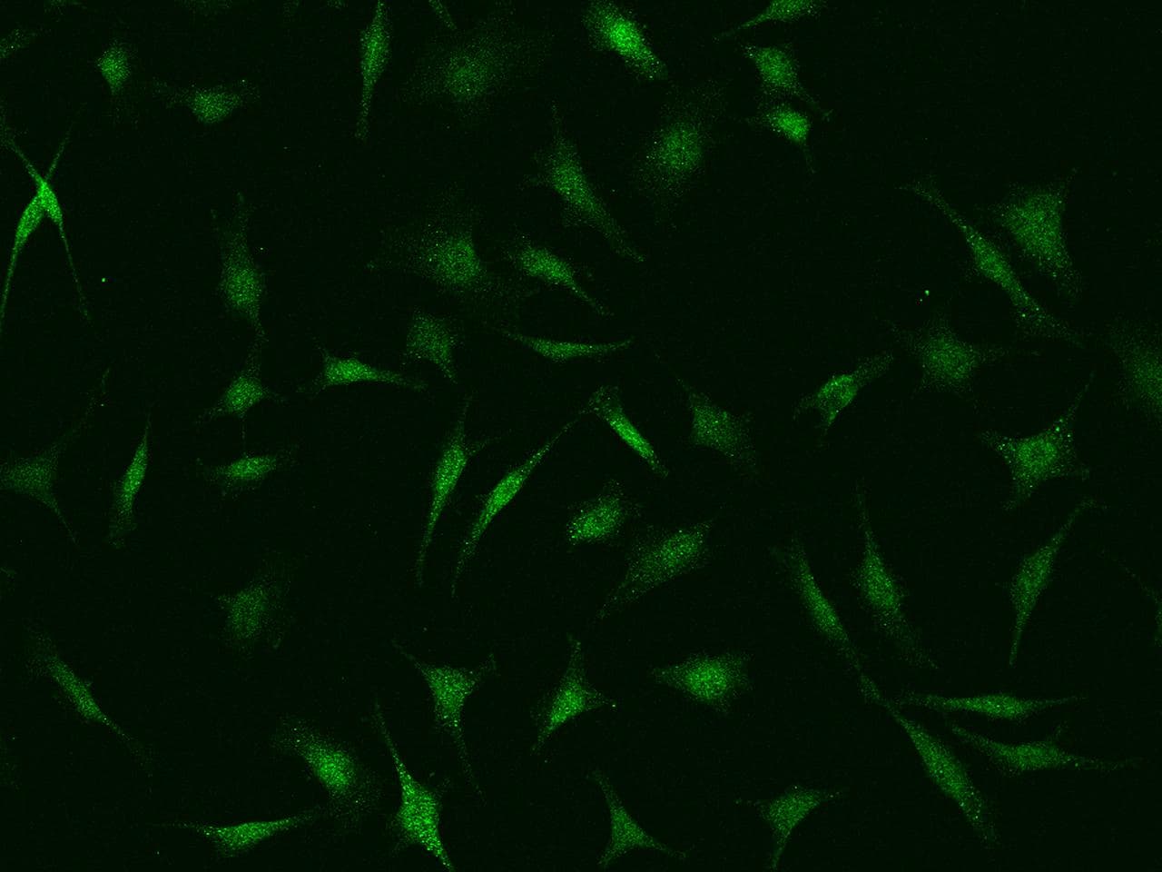 PSMC6 Antibody
