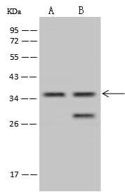 TSEN34 Antibody