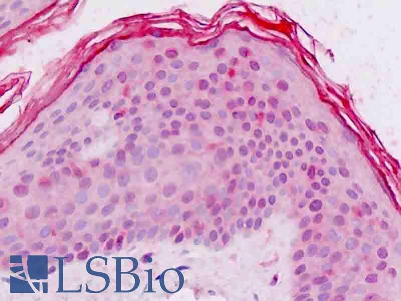 IHC-plus™ Polyclonal Rabbit anti-Human UBE2D1 / UBCH5 Antibody (aa111-140, IHC, WB)