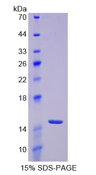 Mouse TNFRSF19 / TROY Protein (Recombinant His-T7)