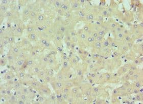 Polyclonal Rabbit anti-Human IL13RA2 / IL13R Alpha 2 Antibody (aa27-343, IHC)