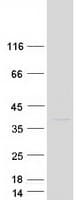 Human COMMD8 Protein (Recombinant Myc-DDK (Flag))
