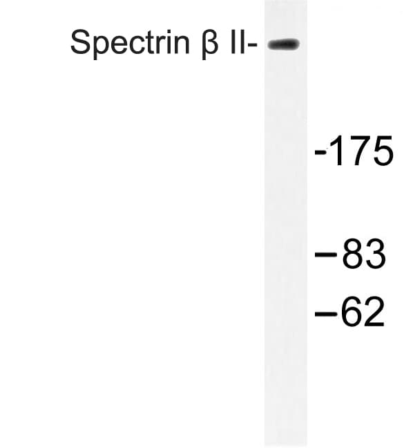 SPTBN2 Antibody (Met687)