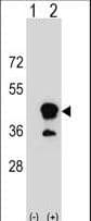 CD1B Antibody (aa57-85)