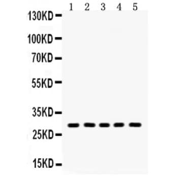 Polyclonal Rabbit anti-Human AQP1 / Aquaporin 1 Antibody (aa240-269, IHC, WB)