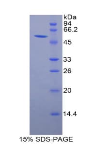 Rat GZMM / Granzyme M Protein (Recombinant His-GST)