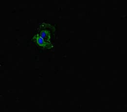 Polyclonal Rabbit anti-Human FBXW5 Antibody (IHC, IF, WB)