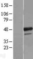 B4GALT3 Protein (Over-Expression Lysate Myc-DDK (Flag))