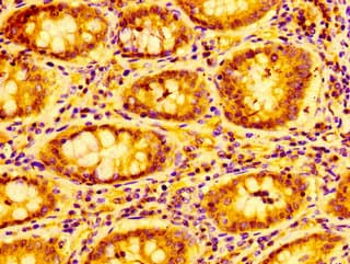 Polyclonal Rabbit anti-Human CXCL9 / MIG Antibody (IHC)