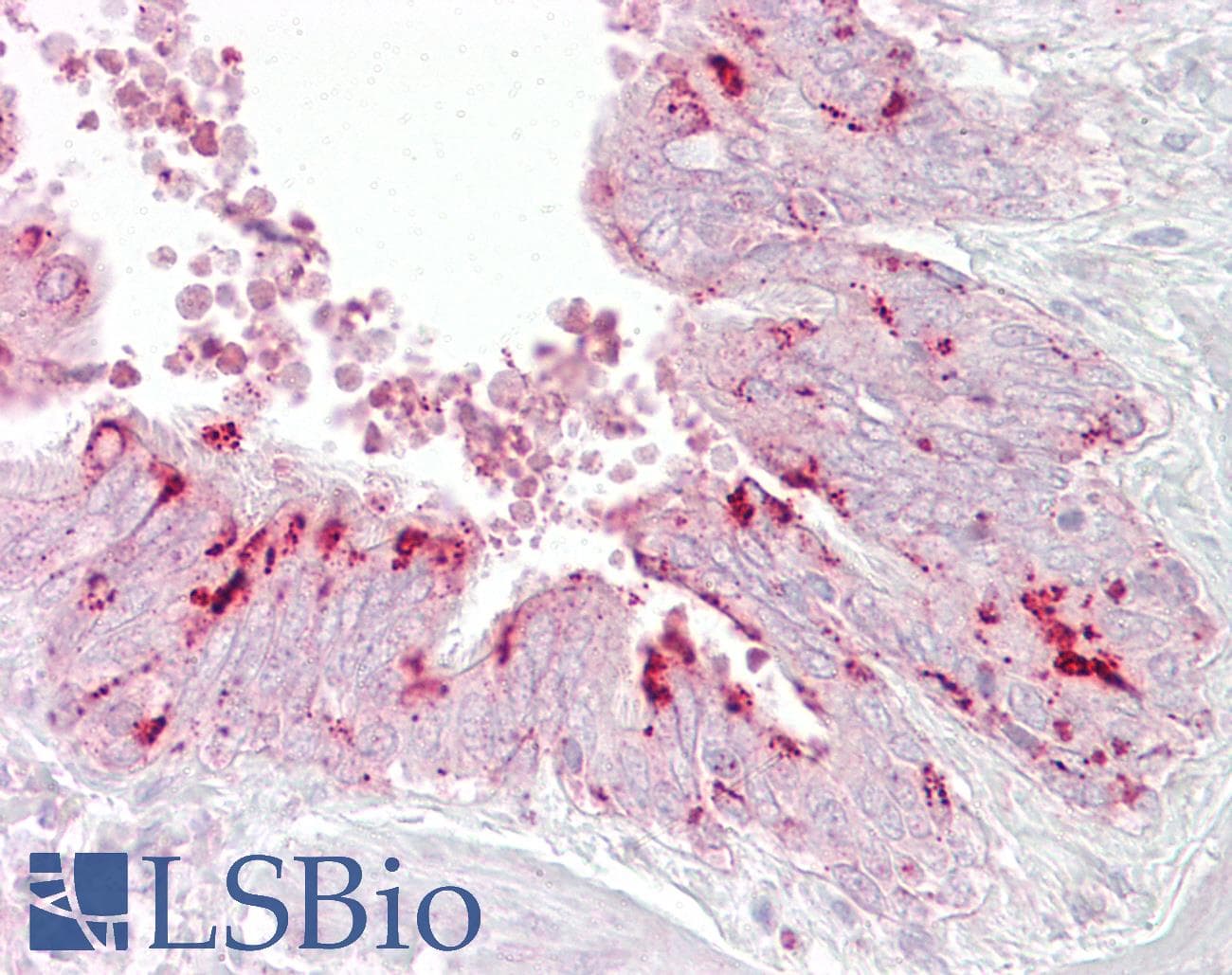 Polyclonal Rabbit anti-Human EIF4E Antibody (C-Terminus, IHC, WB)