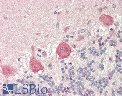IHC-plus™ RPS7 / Ribosomal Protein S7 Antibody