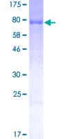 Human Peripherin Protein (Recombinant GST)