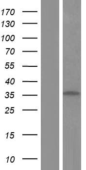 TNNT3 Protein (Over-Expression Lysate Myc-DDK (Flag))