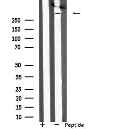 MAP1L / MAP1A Antibody