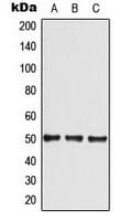 Polyclonal Rabbit anti-Human SLC2A4 / GLUT-4 Antibody (Internal, IHC, WB)