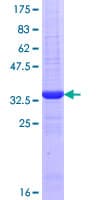 Human AANAT Protein (Recombinant GST, N-terminus)