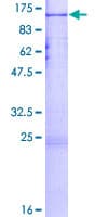 Human Paraplegin / SPG7 Protein (Recombinant GST)