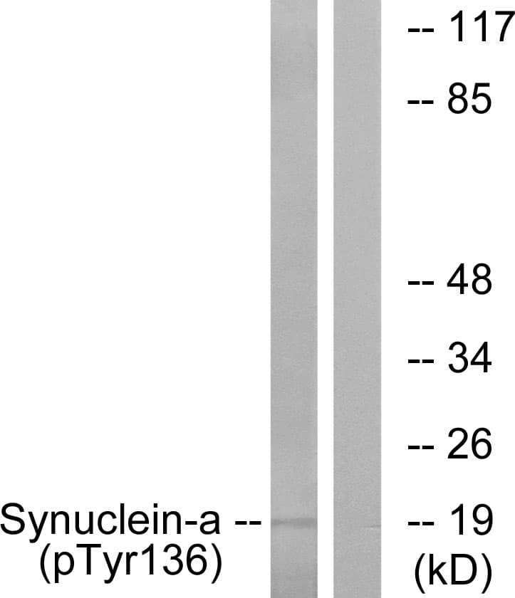 SNCA / Alpha-Synuclein Antibody (phospho-Tyr136)