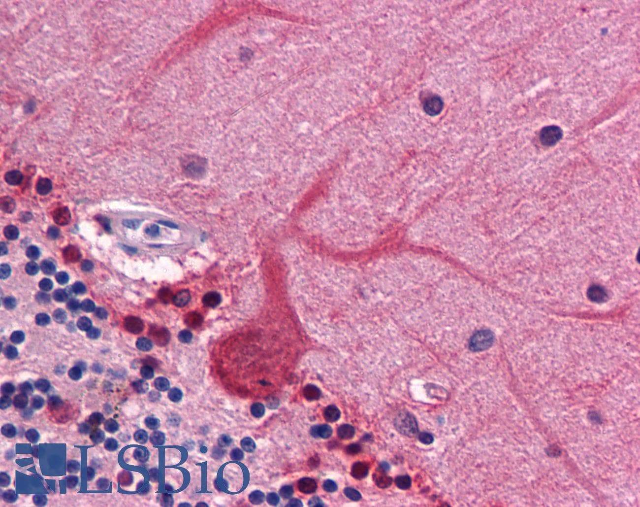 IHC-plus™ CORO1B Antibody (clone 1E7)