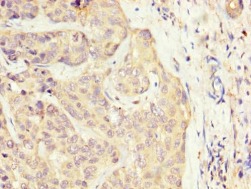 Polyclonal Rabbit anti-Human SLC22A25 Antibody (IHC, WB)
