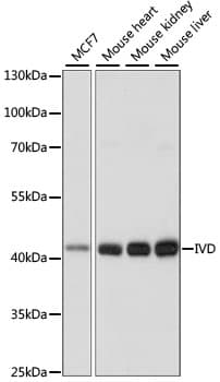 Polyclonal Rabbit anti-Human IVD Antibody (WB)
