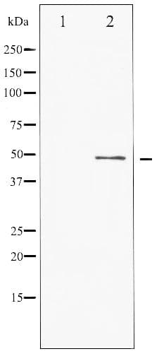 Polyclonal Rabbit anti-Human ATF2 Antibody (phospho-Ser62/44, IHC, WB)