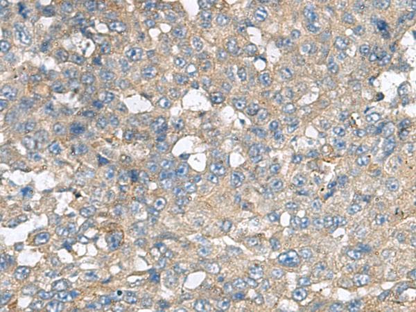 CXCR5 Antibody