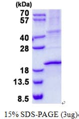 Human RNASE3 Protein (Recombinant His)