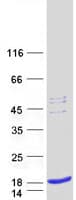 Human SPCS1 Protein (Recombinant Myc-DDK (Flag))