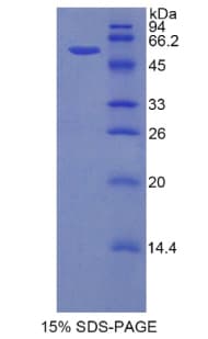 Mouse HK2 / Hexokinase 2 Protein (Recombinant His-GST)