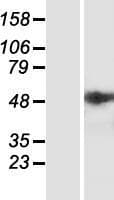 ST6GALNAC2 Protein (Over-Expression Lysate Myc-DDK (Flag))