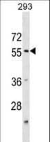 KATNA1 Antibody (aa59-85)