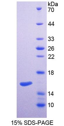 Mouse SPTLC2 / LCB2 Protein (Recombinant His-T7)