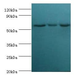 Polyclonal Rabbit anti-Human XIAP Antibody (aa1-200, IHC, WB)