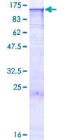Human EXOSC10 Protein (Recombinant GST)