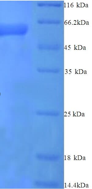 Rat SERPINB2 / PAI-2 Protein (Recombinant His)